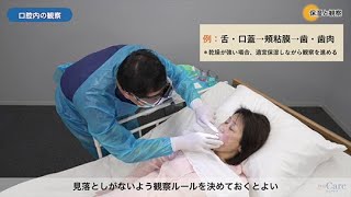 口腔ケア 基本の“き”