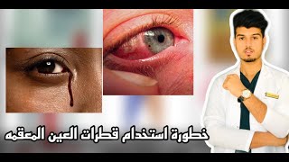 لا يوجد قطرات معقمه للعين .❌