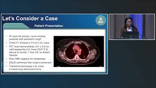 Reinforcing Precision Tactics in Genomically Altered Resectable NSCLC