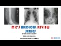 X-rays: 1. (proper audio) General Principles of X rays #Xray_week  #DrMK7