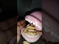 DOLFIN DENTIST EATING PEANUT 🥜 As #asmr #asmrsounds#peanut#shortvideo #shortsfeed#shorts#yt