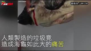 【心碎片】竟從海龜鼻孔拉出這東西！