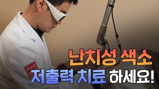 난치성색소는 저출력으로 치료하세요! 꼭이요!