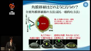 第9回市民公開講座　教育講演　近視のウソ・ホント