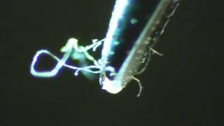 #137 - Viewing, Removing \u0026 Drowning Morgellons