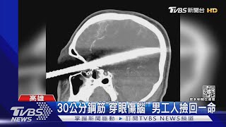 30公分鋼筋「穿眼」 男工人撿回一命 認出妻兒「感動」｜TVBS新聞