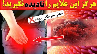 هشدارجدی❌ هرگز این علایم را نادیده نگیرید. نشانه‌های زودهنگام سرطان روده بزرگ