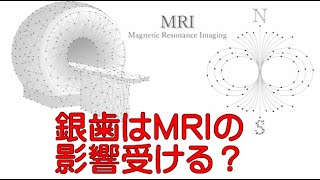 銀歯の人がMRIで歯が痛くなるのは電磁波過敏症の可能性大！ケース１