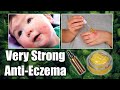 Very strong Anti-Eczema