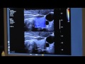 How To Elastography