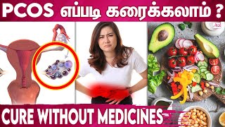 Natural Treatment For PCOS | Causes of Polycystic Ovarian Syndrome | Irregular Periods