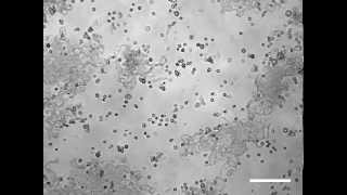 growing a BUG of sorts in cell culture any idea what is this???