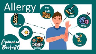 Allergy | allergy treatment | Allergy symptoms | Type I hypersensitivity