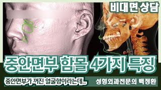 (SUB) 중안면부 함몰의 4가지 특징 [비대면상담 262] / 4 characteristics of mid-face depression