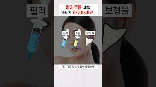 팔자주름에는 필러 말고 스컬트라 시술을 받으라고? feat. 필러 이동, 지방이식, 보형물 #팔자스컬트라 #sculptra #모즈클리닉 #modsclinic #shorts