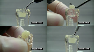 ESTELITE BULK FILL FLOW im Vergleich  | Tokuyama Dental