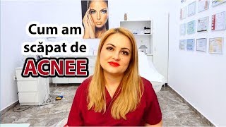 Cum am scapat de acnee? | Povestea unui dermatolog