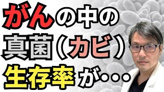 【最新】がん内部の真菌（カビ）「マラセチア・グロボーサ」が生存率に影響？医師が研究結果を解説