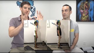 Amazing Posture Correction Results- Lifespring Chiropractic, Austin TX