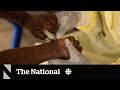 Mpox cases surge in Toronto as Africa declares a health emergency