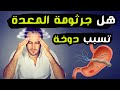 هل جرثومة المعدة تسبب دوخة