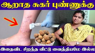 இதை விட சுகர் புண்ணுக்கு அருமையான வீட்டு வைத்தியம் கிடையாது | Yogam Nalamudan