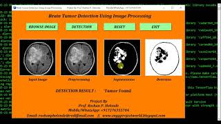 Brain Tumor Detection Using Python OpenCV || Final Year Project || Biomedical Project | IEEE Project