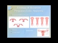 Pregnancy Loss/ Miscarriage causes and medical treatment options Dr Carrie Wambach Pregnancy Loss/ Miscarriage causes and medical treatment options Dr Carrie Wambach
