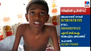 അപൂർവരോഗം ബാധിച്ച 12 കാരൻ സഹായം തേടുന്നു  | Kottayam Treatment help Nikhil