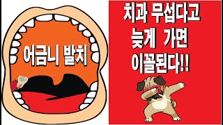 어금니 발치(치과 늦게가면 이꼴난다)생얼공포