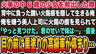 【感動する話】火事の中6歳の少女を救出した際背中に負った醜い火傷痕を隠して生きる俺。俺を嫌う美人上司に火傷の痕を見られて「やっと見つけた。君のせいで妹は」→目の前に黒塗りの高級車が停まり…