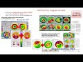 ray tracing excimer laser customization explained treating myopia with lasik and keratoconus