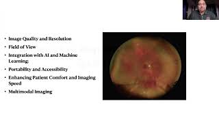 Lecture: Widening Role of Wide-Field Imaging for Today’s Ophthalmology