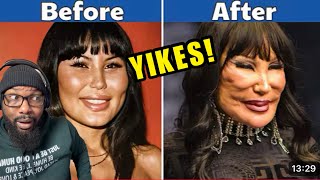 OH NO! 40 Celebrities Before and After Plastic Surgery | REACTION