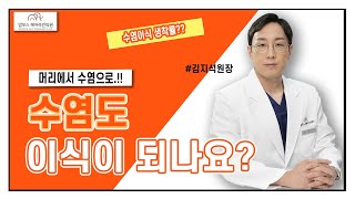 수염 이식이란??  모발이식병원 I 헤어라인교정 I 맘모스