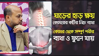 ঘাড়ের হাড় ক্ষয়, কোমরের কটির নিচে ব্যথা, কোমর থেকে সম্পূর্ণ শরীর ব্যথা ও ফুলে যায় | Arthritis