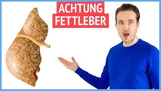 Fettleber - Deshalb ist sie so gefährlich und wird enorm unterschätzt