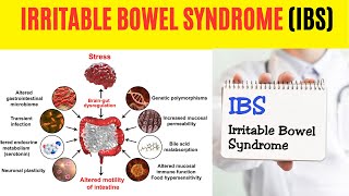 Uncovering the Mystery of Irritable Bowel Syndrome (IBS): What You Need to Know Now!