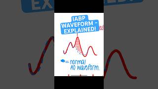 IABP (Intra Aortic Balloon Pump) Waveform & Timing Made Simple #cathlab #icunurse #ccu #iabp
