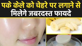 Skin Care: पके-गले केले का चेहरे पर करें इस्तेमाल, 5 मिनट में दमक उठेगा चेहरा । Boldsky