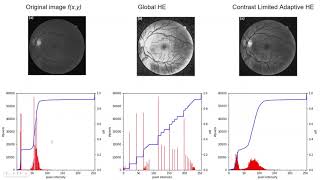 Python#4 Histogram Equalization and Adaptive Histogram Equalization in Python
