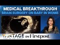 US: In a First, Doctors Perform Brain Surgery on Baby in Womb | Vantage with Palki Sharma