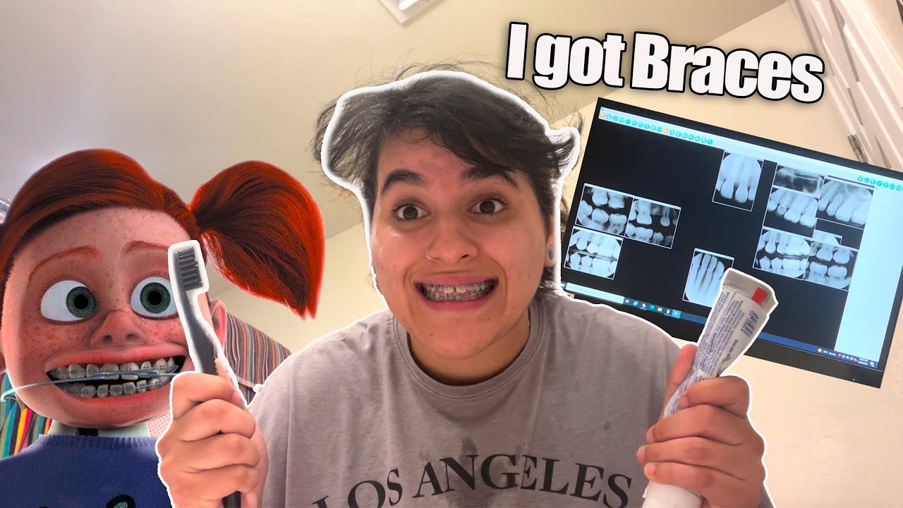 Getting My Braces Vlog Youtube