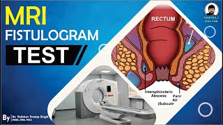 MRI Fistulogram Test || Anal Fistula || MRI Test