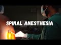 How to give spinal anesthesia ? LEARN IN 1 MINUTE