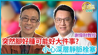 突然腳好腫可能好大件事? 小心深層靜脈栓塞