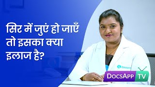 सिर में जुएं हो जाएँ तो इसका क्या इलाज है? Hindi | DocsAppTv  #AsktheDoctor