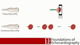 An Introduction To Spectral Doppler