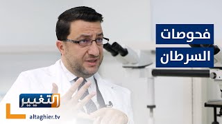 ما هي الفحوصات المطلوبة للكشف عن السرطان؟