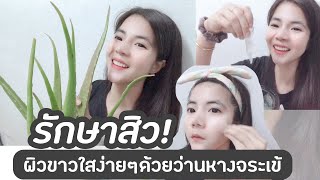 อยากสวย EP:79 | รักษาสิวผิวหน้าขาวใส  จบปัญหาฝ้ากระจุดด่างดำ พอกหน้าด้วยว่านหางจระเข้ !